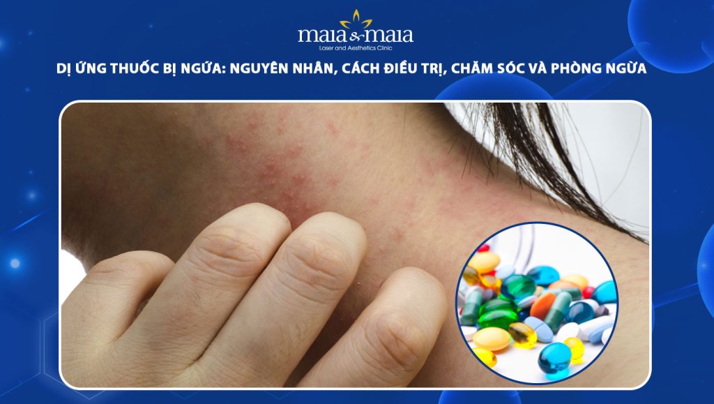 dị ứng thuốc bị ngứa