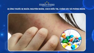 dị ứng thuốc bị ngứa