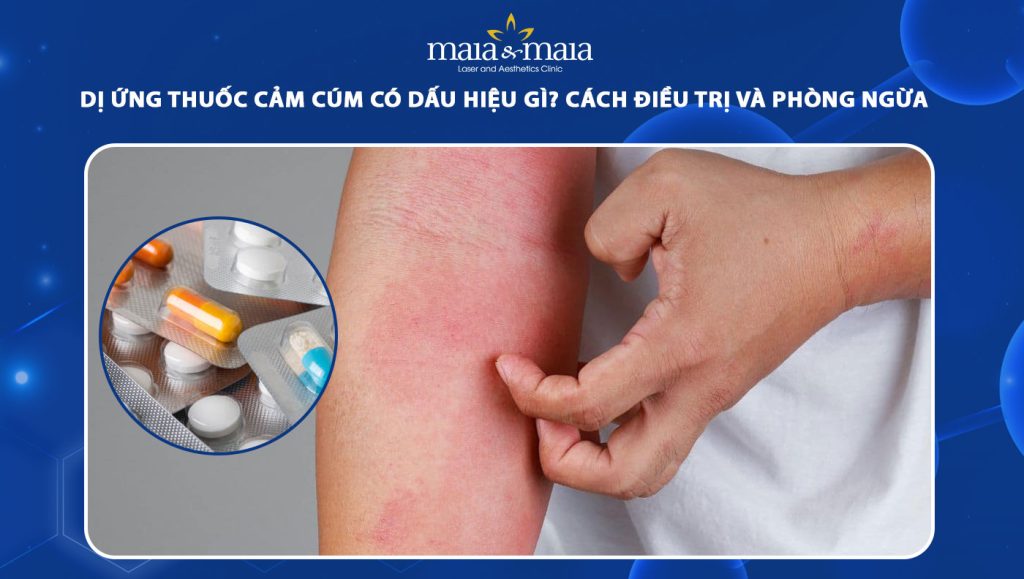 dị ứng thuốc cảm cúm