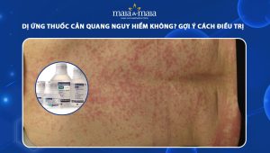 dị ứng thuốc cản quang