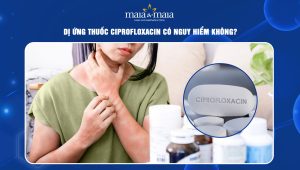 Dị ứng thuốc Ciprofloxacin