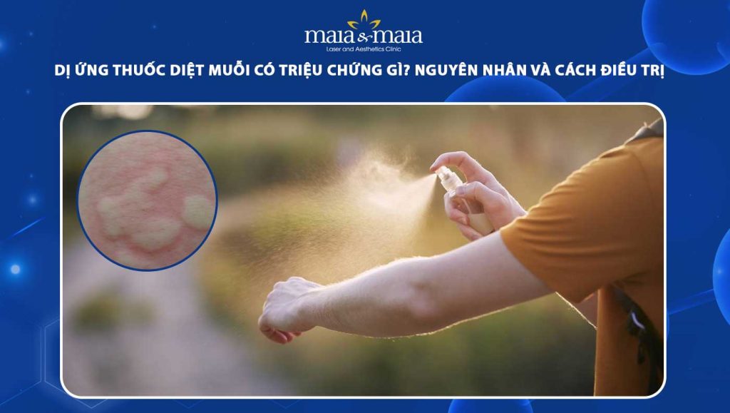 Dị ứng thuốc diệt muỗi có triệu chứng gì? Cách khắc phục 1 dị ứng thuốc diệt muỗi