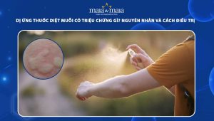 dị ứng thuốc diệt muỗi