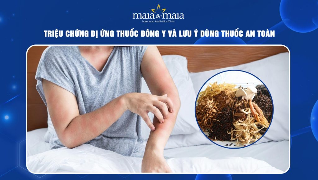 dị ứng thuốc Đông y