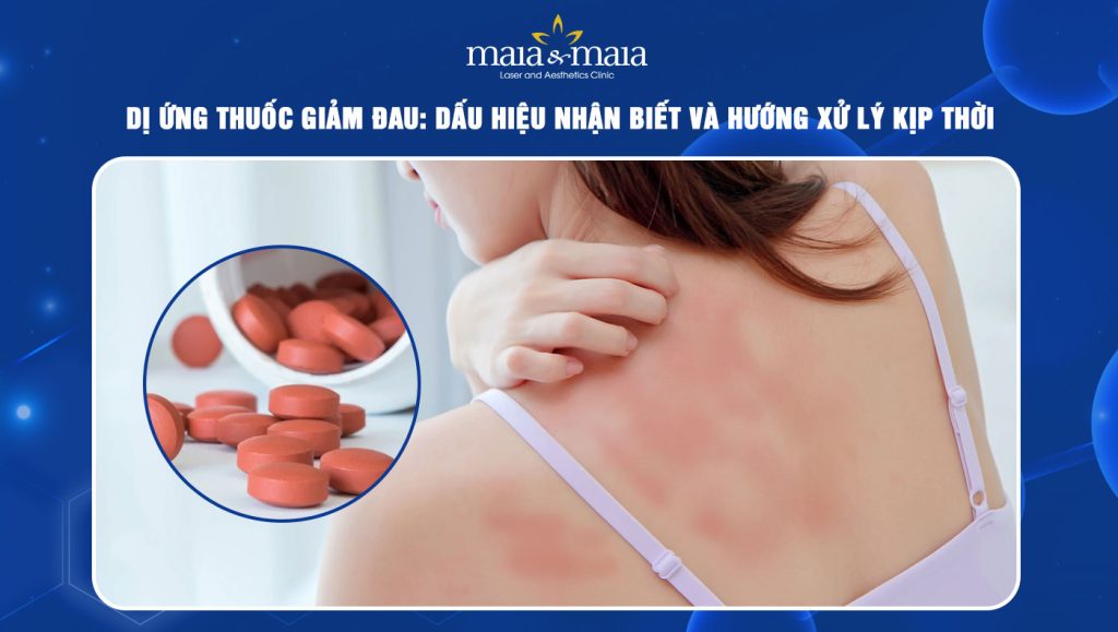 Dị ứng thuốc giảm đau