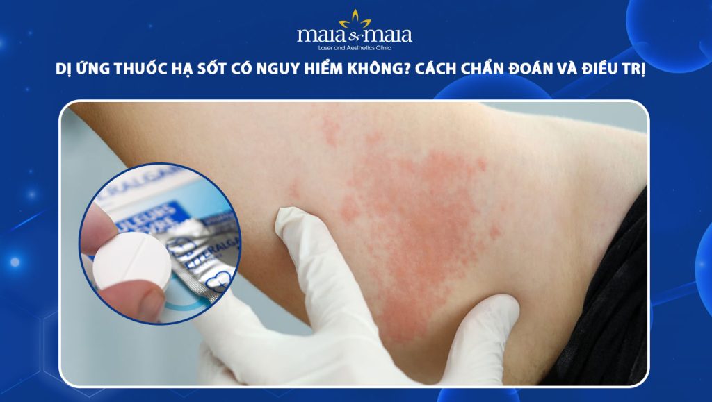 dị ứng thuốc hạ sốt