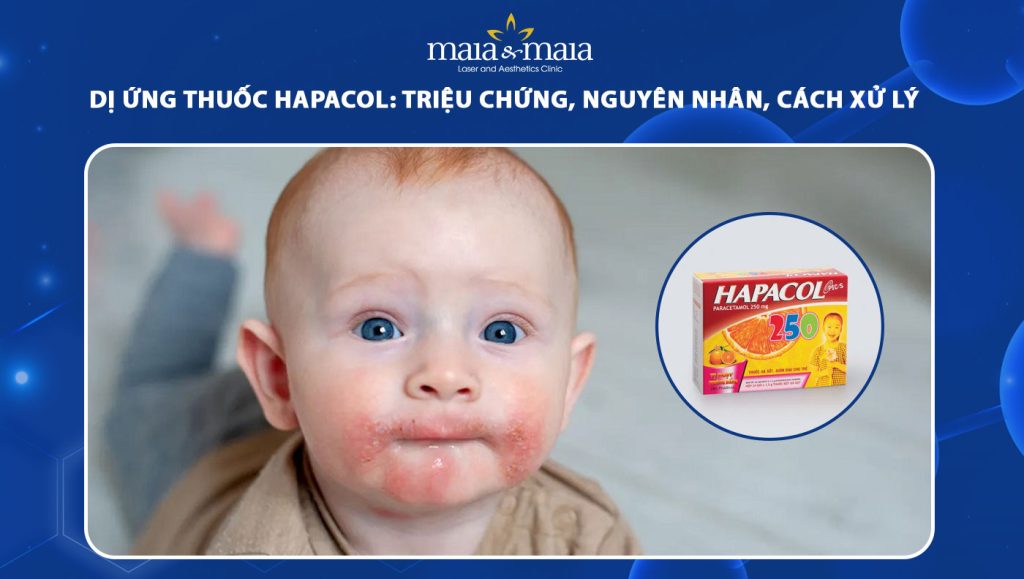 dị ứng thuốc hapacol