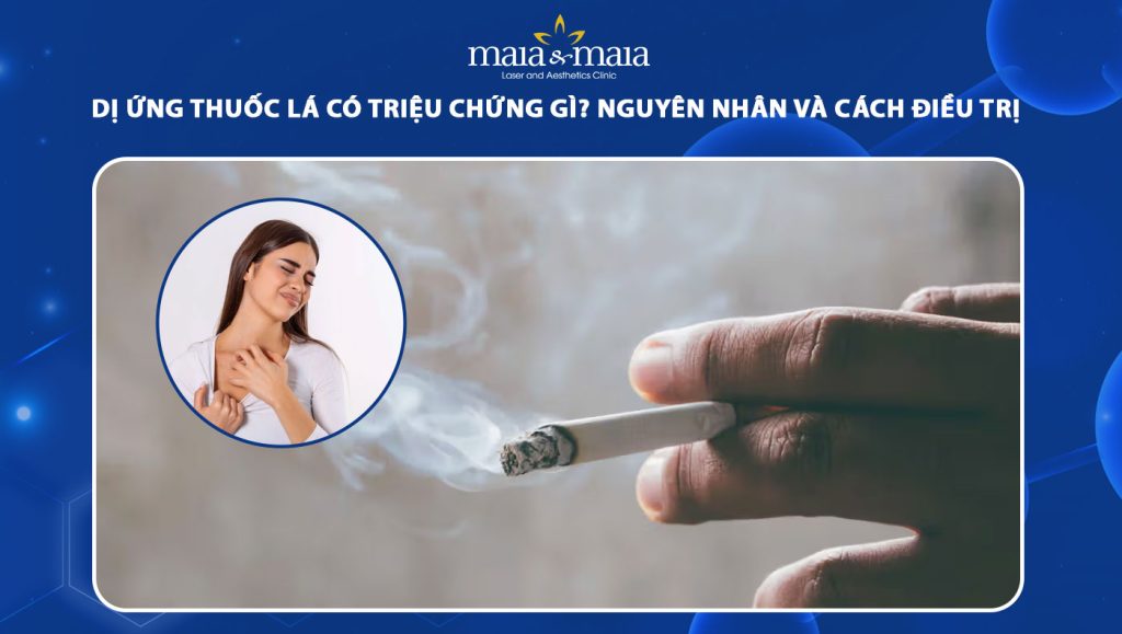 dị ứng thuốc lá