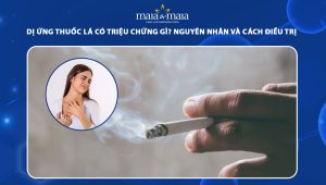 dị ứng thuốc lá