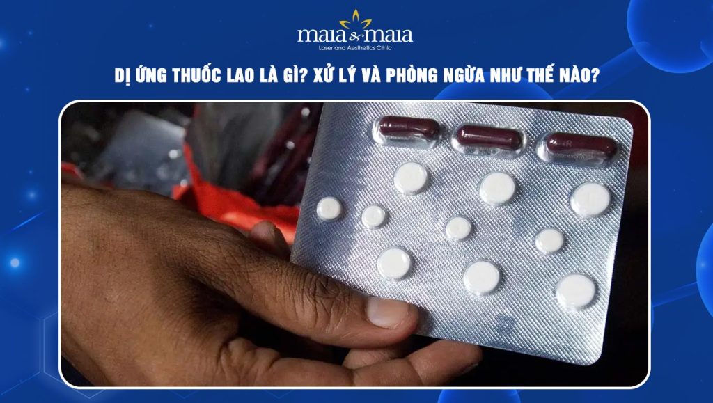 dị ứng thuốc lao