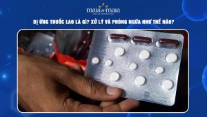 dị ứng thuốc lao