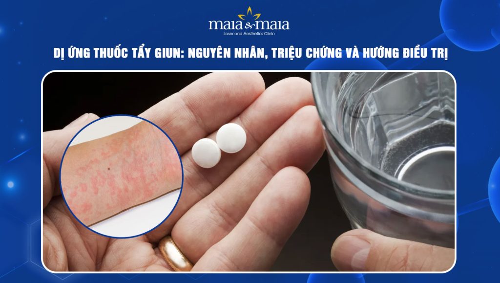 dị ứng thuốc tẩy giun