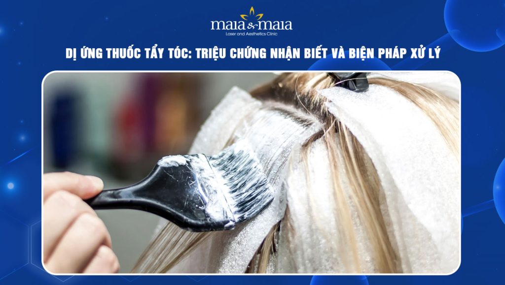 dị ứng thuốc tẩy tóc