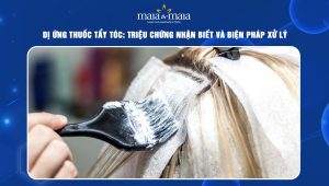 dị ứng thuốc tẩy tóc