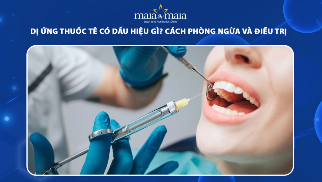 dị ứng thuốc tê