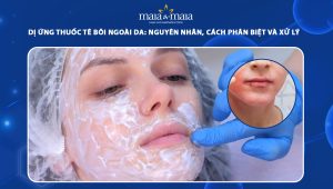 dị ứng thuốc tê bôi ngoài da