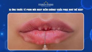 dị ứng thuốc tê phun môi