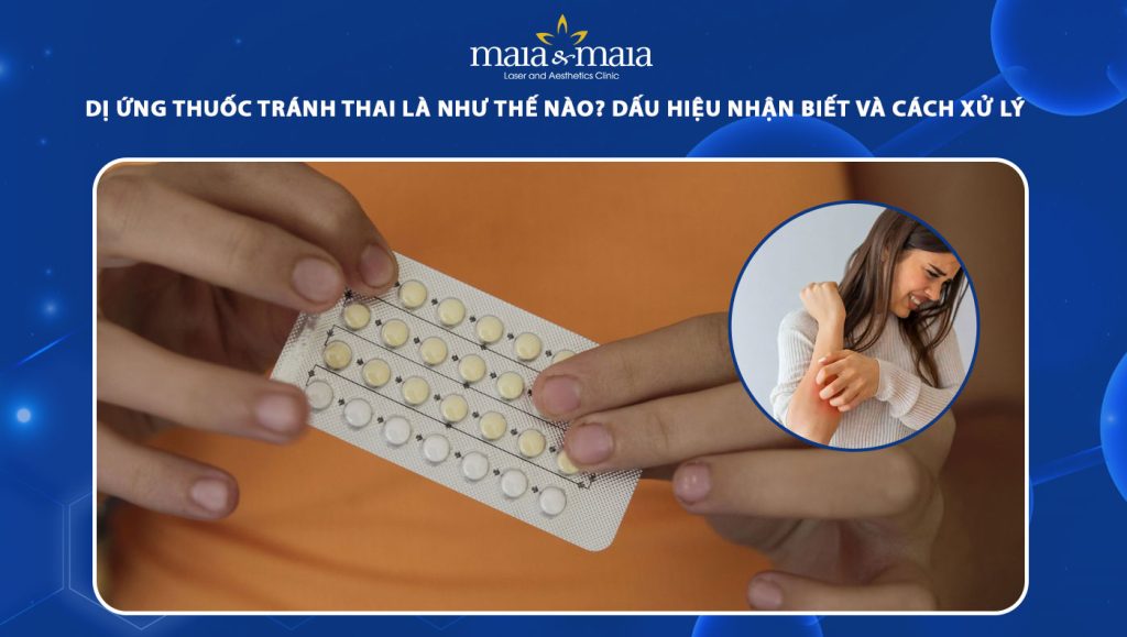 dị ứng thuốc tránh thai