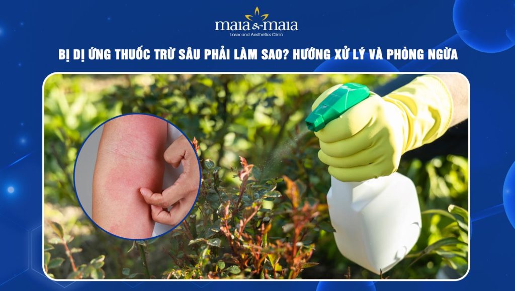 dị ứng thuốc trừ sâu