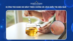dị ứng trà xanh