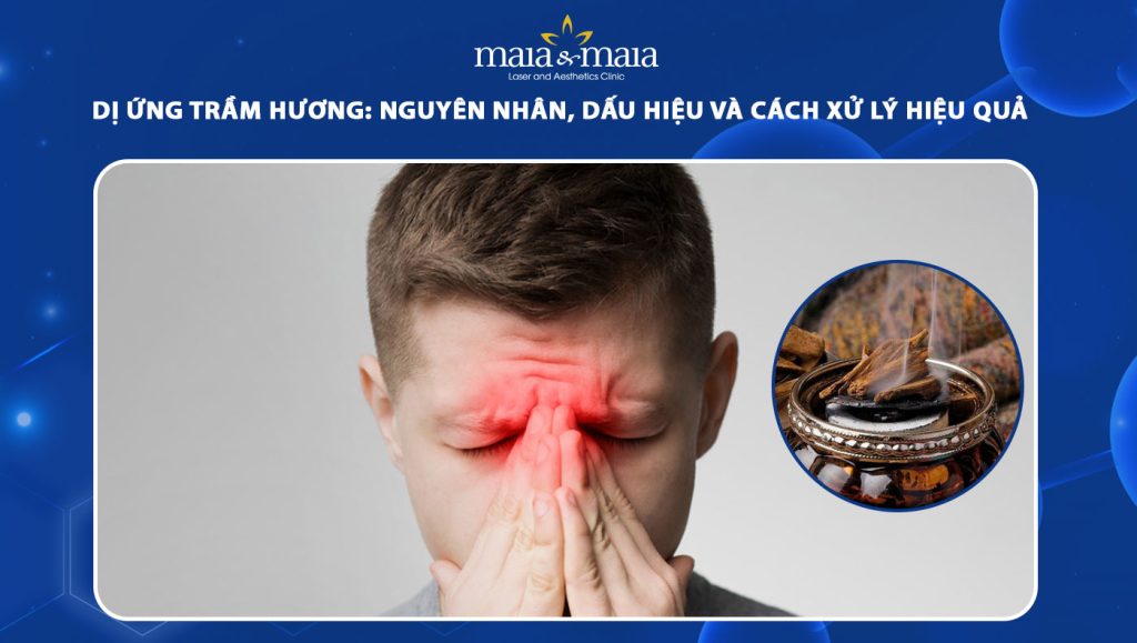 dị ứng trầm hương