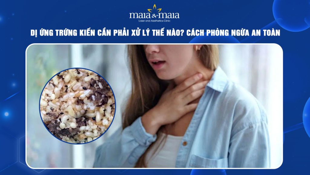 dị ứng trứng kiến