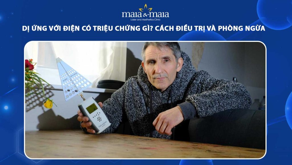 dị ứng với điện