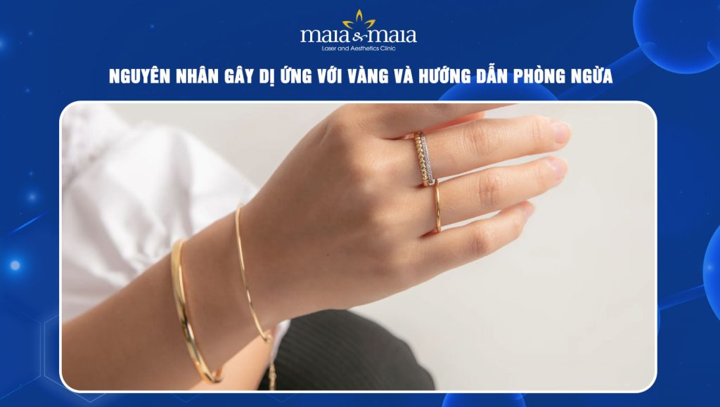 Dị ứng với vàng