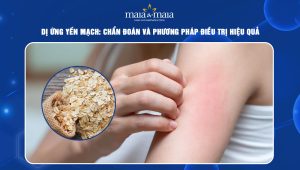 Dị ứng yến mạch