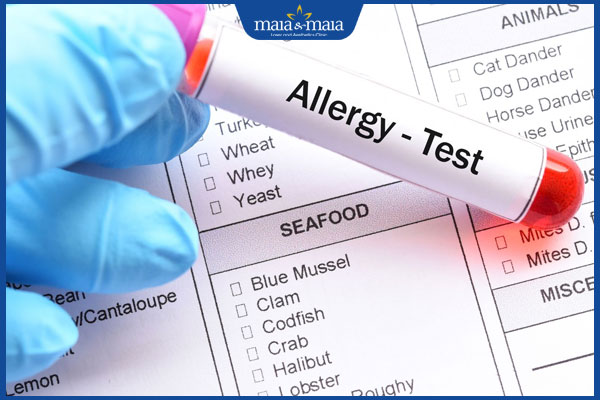 giá xét nghiệm dị ứng