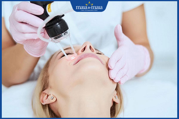 Ưu điểm khi trị sẩn cục bằng Laser CO2 và chi phí thực hiện 2 laser co2 trị sẩn cục