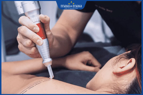 laser trị ngứa da