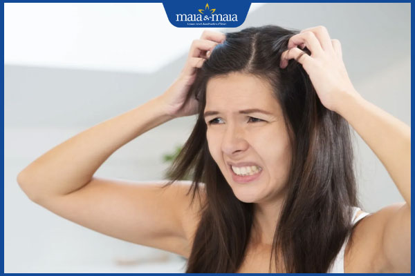 Viêm nang lông da đầu là gì? Cách xử lý, phòng ngừa hiệu quả 5 ngứa đầu