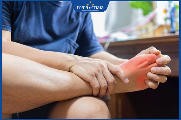 Dị ứng măng: Triệu chứng nhận biết và cách xử lý hiệu quả 4 người bệnh gout