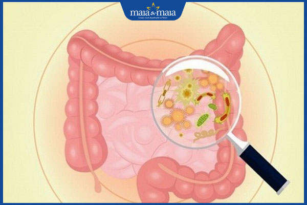 Dị ứng Lactose do đâu? Triệu chứng, cách xử lý và phòng ngừa 3 nhiễm trùng đường ruột