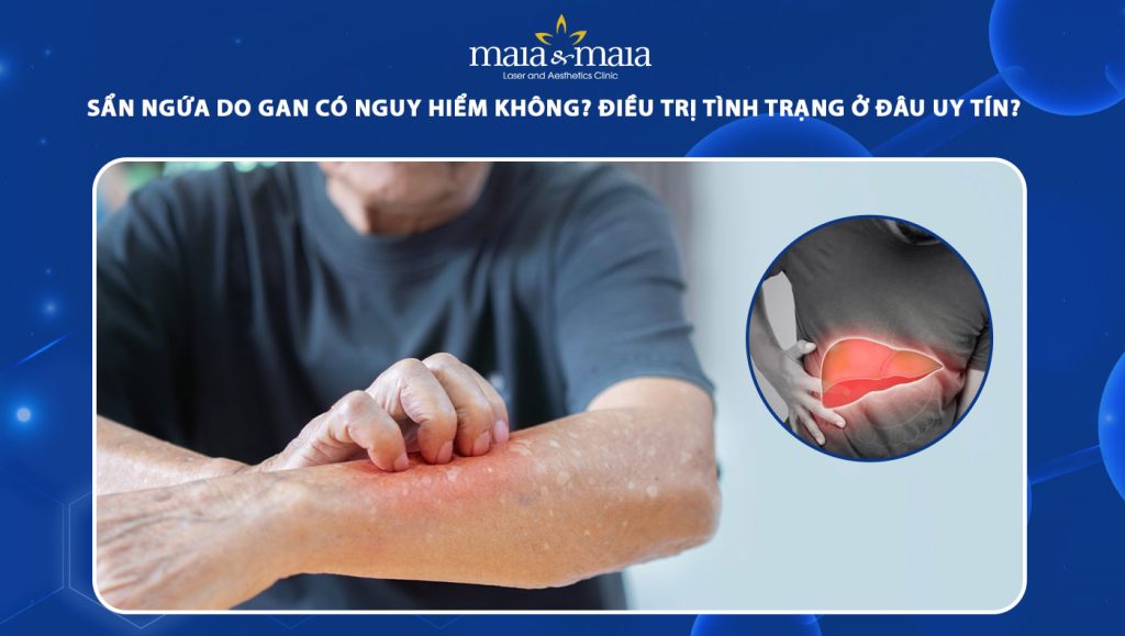 sẩn ngứa do gan