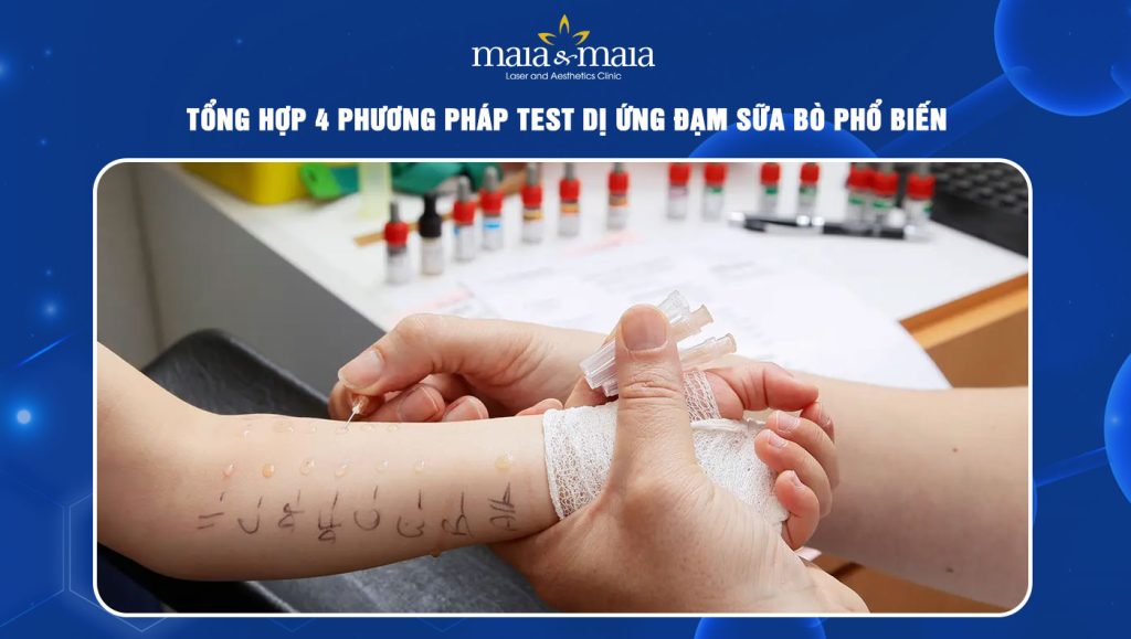 Test dị ứng đạm sữa bò