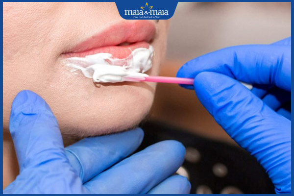 thoa thuốc tê môi