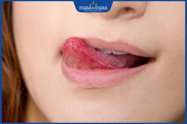 thói quen liếm môi