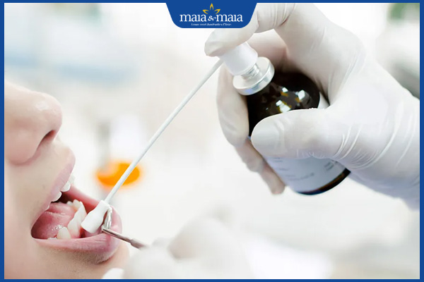 Dị ứng thuốc tê nhổ răng là gì? Biện pháp xử lý & phòng ngừa 2 thuốc tê nhổ răng