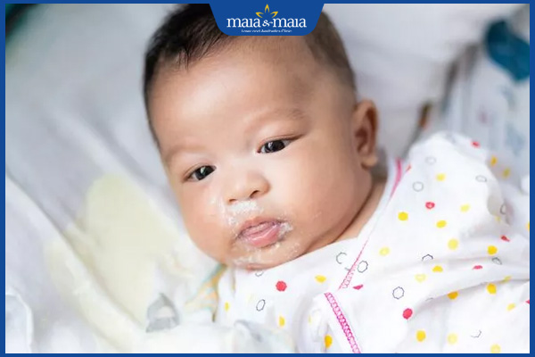 Dị ứng đạm sữa bò ở trẻ có nguy hiểm không? Hướng xử lý 6 trẻ nôn trớ