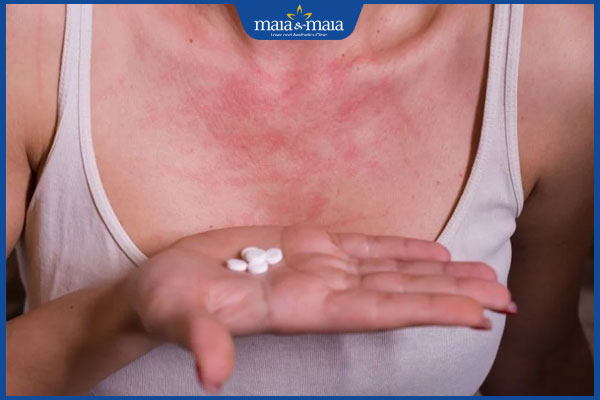 tương tác thuốc gây dị ứng