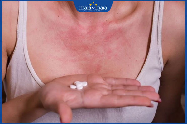 uống thuốc chữa dị ứng