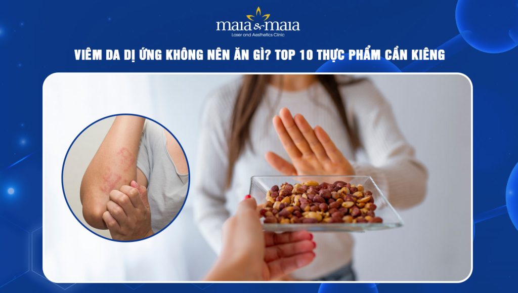 viêm da dị ứng không nên ăn gì