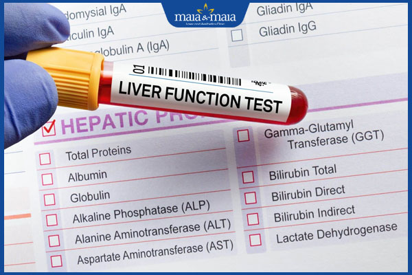 xét nghiệm chức năng gan