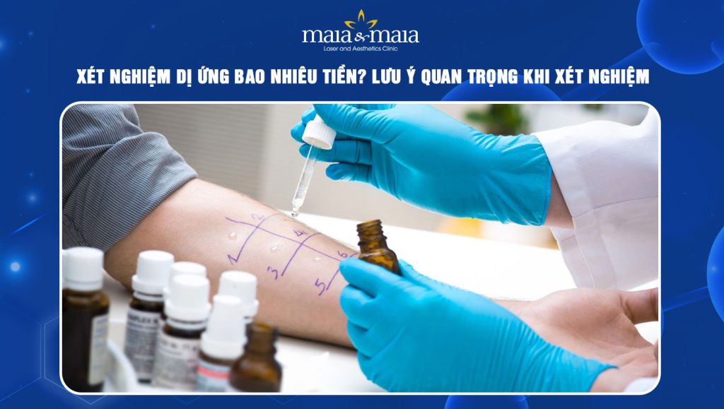 Xét nghiệm dị ứng bao nhiêu tiền