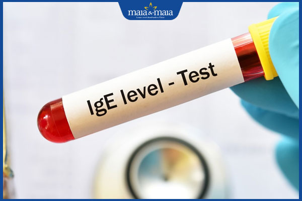 Dị ứng thực phẩm: Nguyên nhân, triệu chứng và cách điều trị 5 xét nghiệm ige