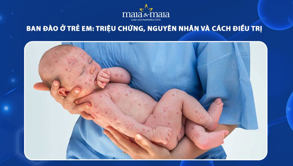 ban đào ở trẻ em