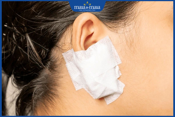 băng vết thương ở tai