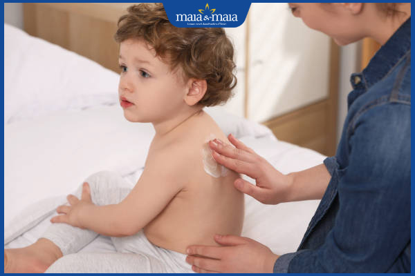 U mềm lây ở trẻ em nguy hiểm không? Cách điều trị hiệu quả 4 bôi thuốc cho trẻ